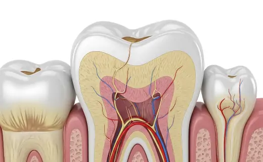 できるだけ神経・歯を残したい