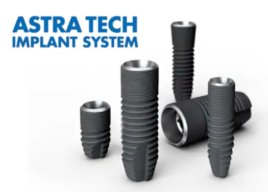 当院のインプラントにおける特徴