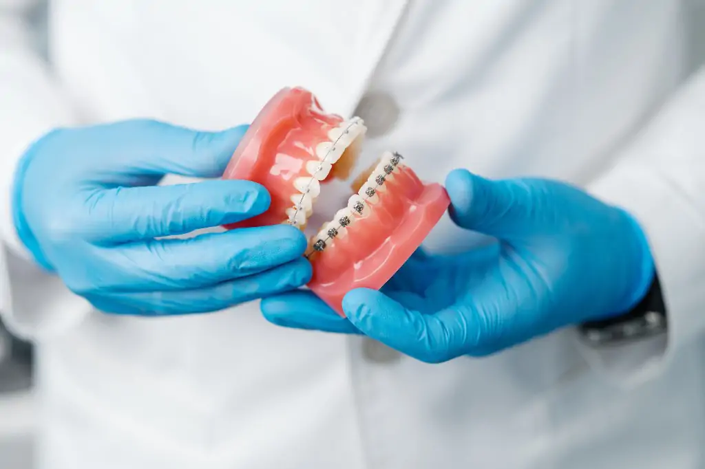 当院の矯正歯科における特徴