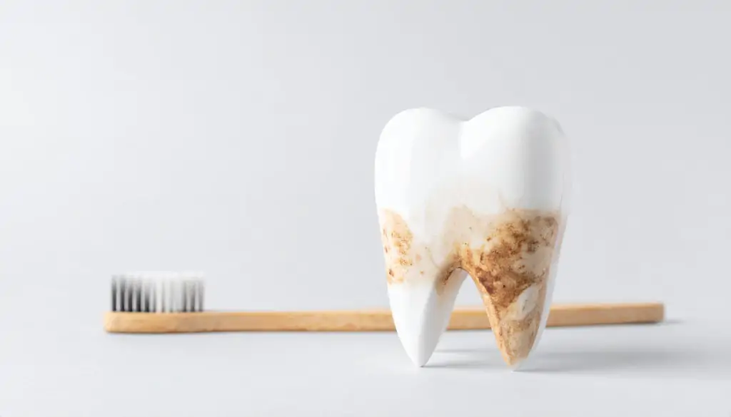 歯が黄ばんでいる・着色が気になる