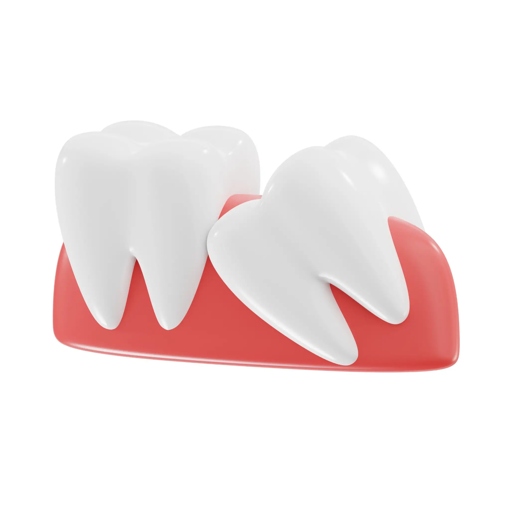 親知らずが痛い・腫れた