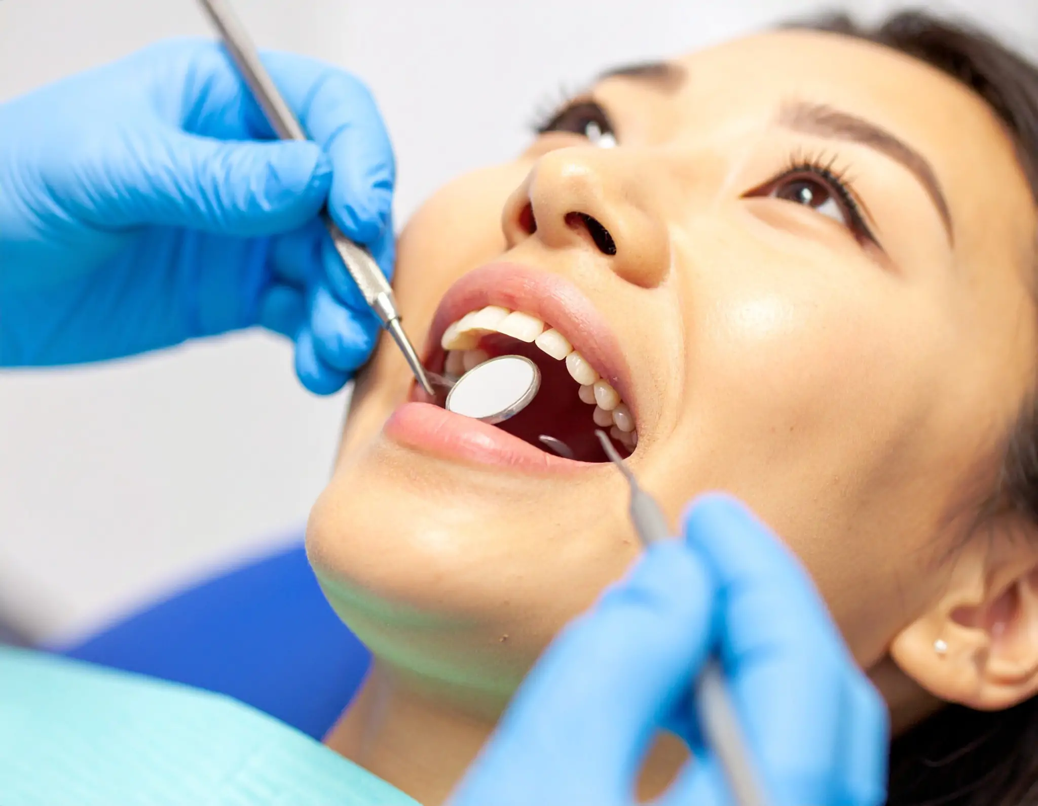 当院の親知らずの抜歯における特徴