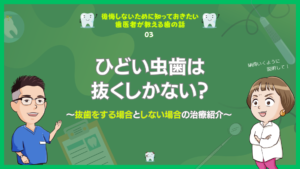 ひどい虫歯は抜くしかない？～抜歯をする場合としない場合の治療紹介～