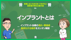 インプラントとは～インプラント治療の流れ・骨造成・長持ちする条件をカンタン解説～
