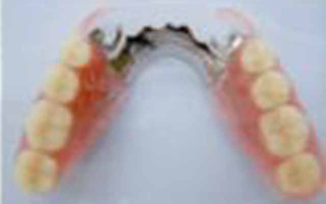 オーダーメイド義歯