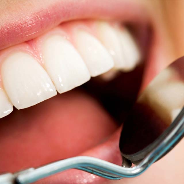 歯の健康寿命