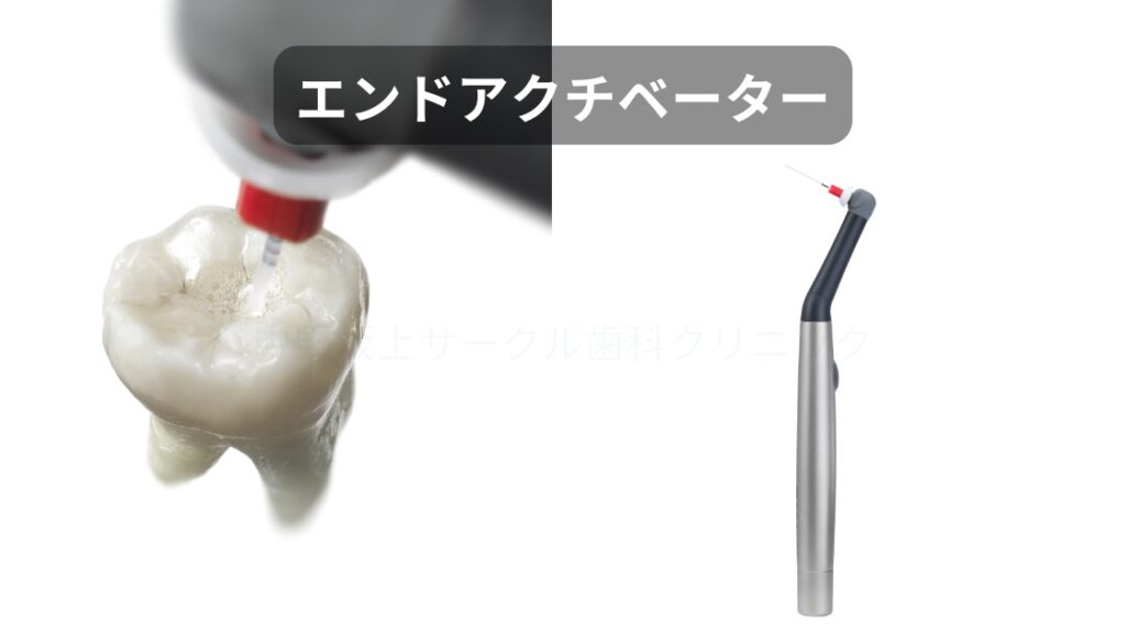 エンドアクティベーター